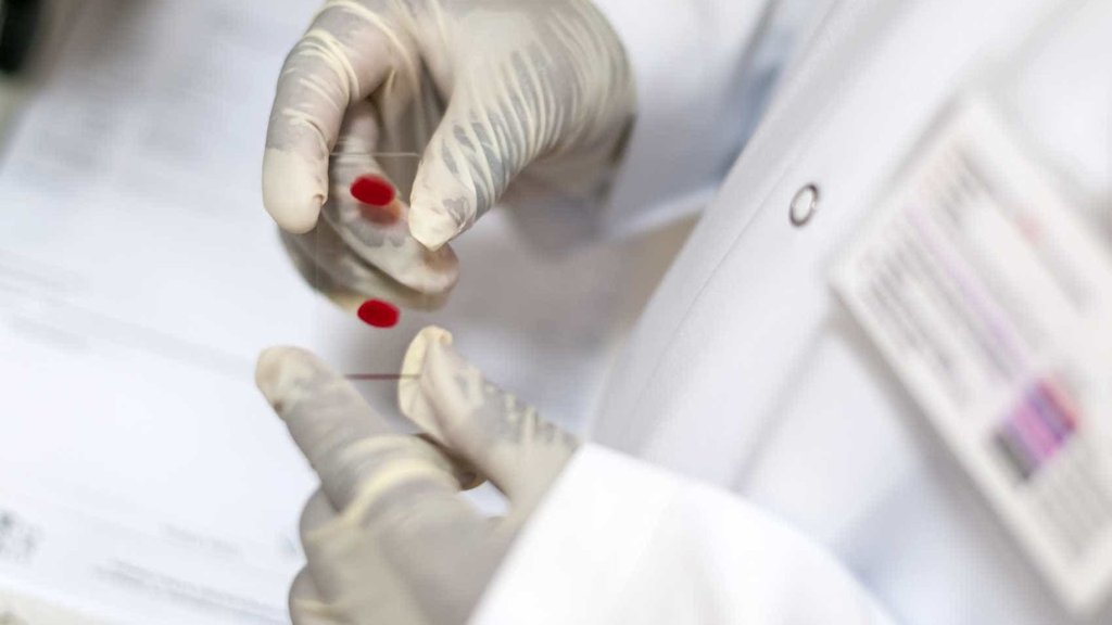 Alerta de saúde pública: ECDC revela que cinco milhões de europeus vivem com hepatite viral crónica