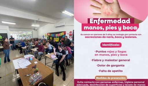 Brote del virus Coxsackie provoca suspensión de clases en Tijuana y otros municipios