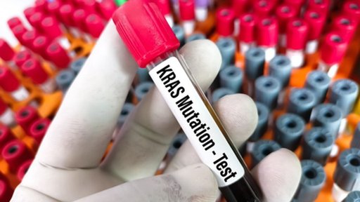 Terapia de edição genética consegue eliminar mutações causadoras de cancros letais