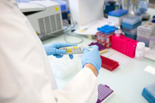 La biotech Abivax flambe en Bourse, alimentant les spéculations de rachat