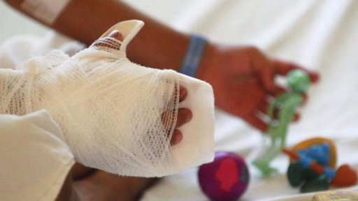 Inicio de diciembre deja al menos 11 quemados por pólvora en Antioquia y 8 en el Valle del Cauca