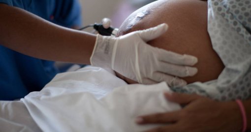 Encerramentos de Obstetrícia na Margem Sul Agravam Risco para Grávidas