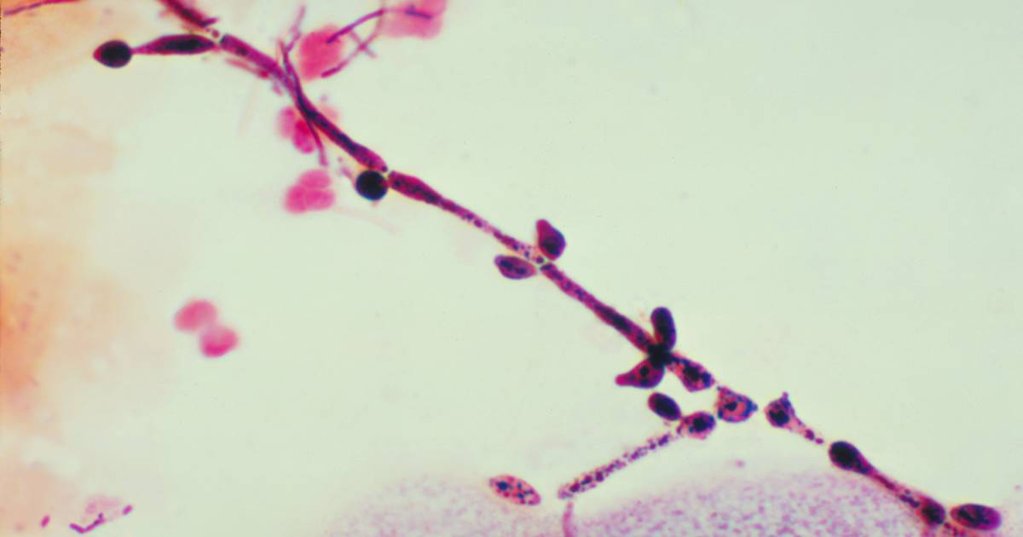 Investigadores portugueses desenvolvem vacina experimental contra a candidíase invasiva