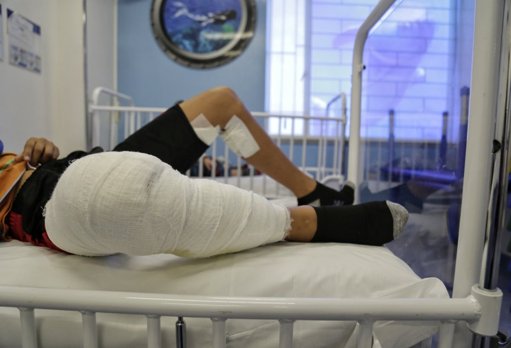 Cifra de quemados por pólvora en diciembre supera los 800 casos a nivel nacional