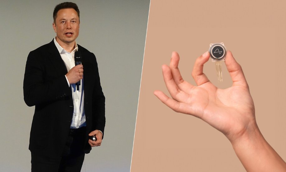 Neuralink de Elon Musk reporta éxito en su primer implante cerebral en humanos