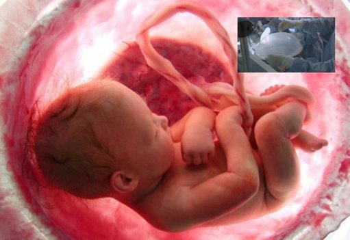 Desarrollan un útero artificial para salvar a bebés prematuros extremos