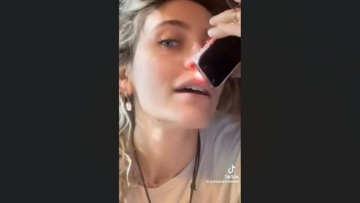 Paris Jackson Revela en TikTok las Secuelas Físicas de su Adicción a las Drogas