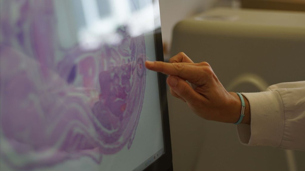 Pandemia de Covid-19 Acelerou Envelhecimento do Cérebro, Mesmo em Não Infetados