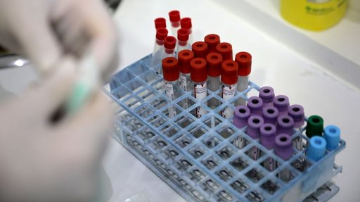 Novo Composto Antiviral (LN-7) Mostra-se Promissor contra o Vírus do Herpes