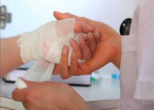 Primer menor quemado por pólvora en Norte de Santander enciende las alertas para la temporada decembrina