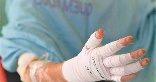 Antioquia lidera las cifras de quemados por pólvora en Colombia