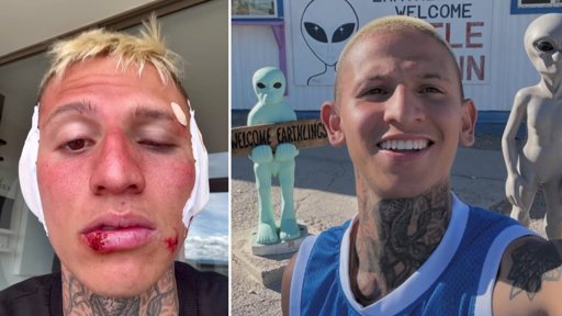 La Liendra reaparece con graves heridas y revela la riesgosa hazaña detrás