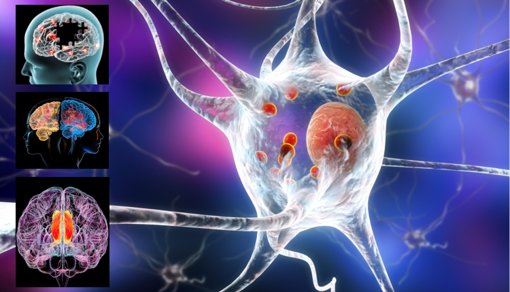 Nanoflores metálicas: una nueva esperanza para el tratamiento de enfermedades neurodegenerativas