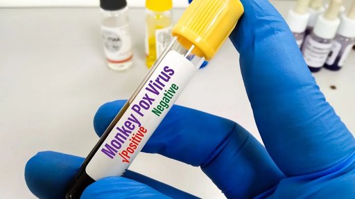OMS Declara Fim da Emergência Internacional para a Mpox, mas Vigilância e Vacinação Mantêm-se