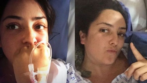 Esmeralda Palacios Narra en Redes Sociales la Explosión de su Implante Mamario