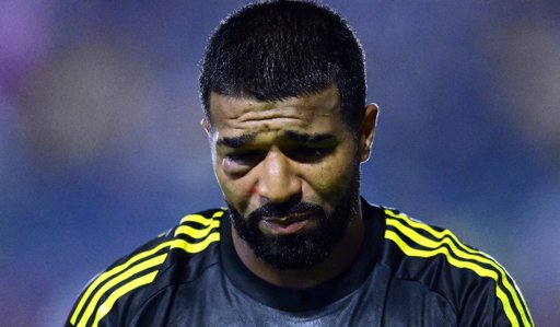 Rodrigo Aguirre sale del campo tras un fuerte golpe en el rostro