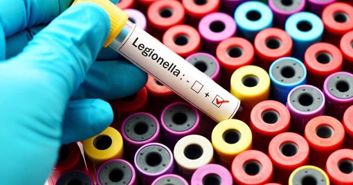 Aumento Recorde de Casos de Legionela em Portugal Lança Alerta de Saúde Pública