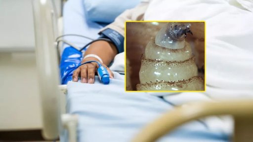 Secretaría de Salud descarta que muertes en Chiapas fueran por miasis de gusano barrenador