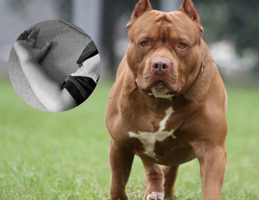 Tragedia en San Alberto, Cesar: niño de dos años muere tras ataque de un perro pitbull