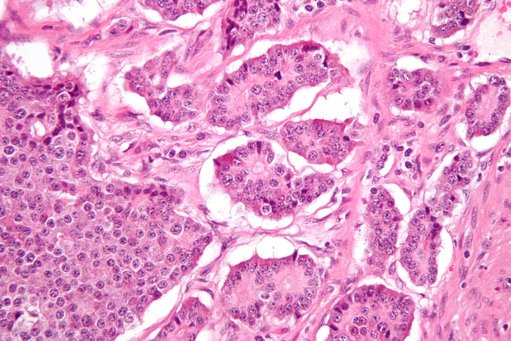 Investigadores do Porto Desenvolvem Terapia Celular Eficaz Contra Tumores Sólidos Agressivos