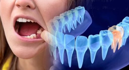 Descubren células madre capaces de regenerar raíces dentales