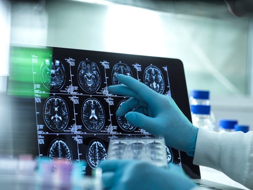 La tecnología avanza para mejorar la objetividad en los diagnósticos psiquiátricos