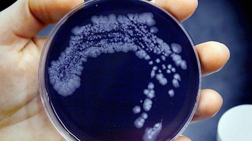 Bactéria 'Legionella' Detetada em Lar de Idosos em Lagos