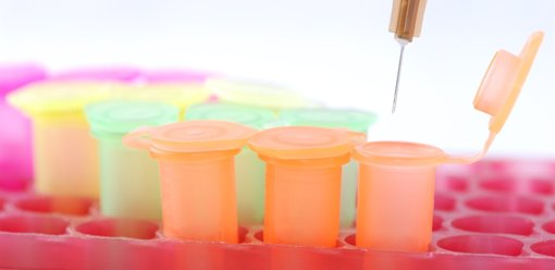 Warburg Pincus entre au capital du français Sebia, valorisé plus de 5 milliards d'euros