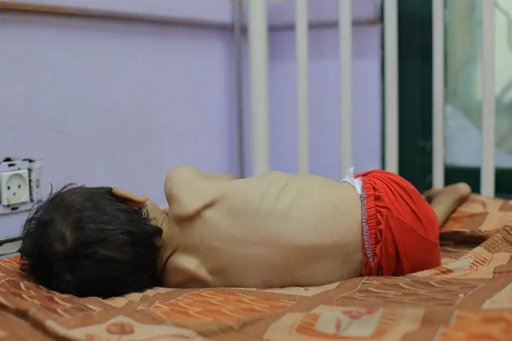 ONU declara oficialmente la hambruna en Gaza en medio del rechazo de Israel