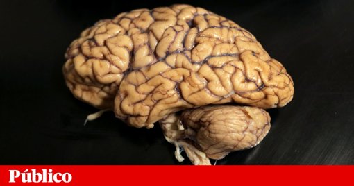 Tratamento Experimental Abranda Progressão da Doença de Huntington