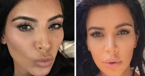 Kim Kardashian revela diagnóstico de aneurisma cerebral y lo atribuye al estrés de su divorcio