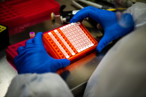 Dispositivo português promete diagnóstico rápido de bactérias e resistência a antibióticos