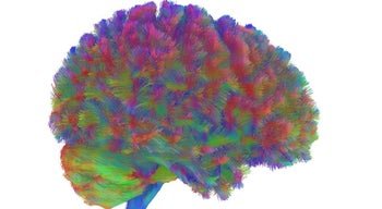 Estudo de Cambridge revela cinco fases distintas no desenvolvimento do cérebro humano