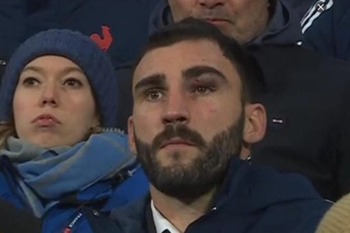 Charles Ollivon sort précocement sur protocole commotion