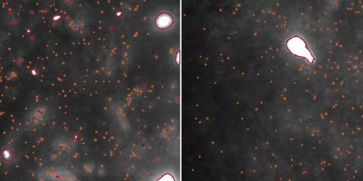 Cientistas Visualizam Pela Primeira Vez Agregados de Proteínas que Causam Parkinson