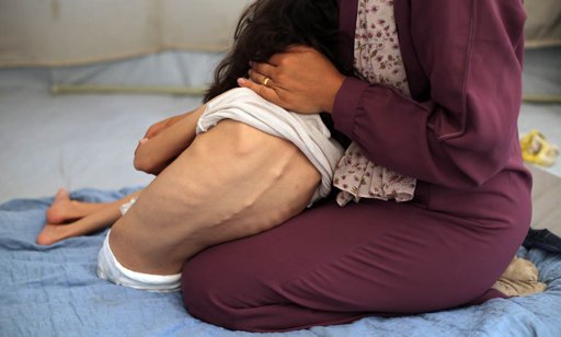 La ONU declara oficialmente la hambruna en Gaza por primera vez en Oriente Medio