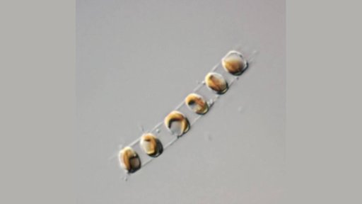 Microalga Marinha Demonstra Potencial para Combater a Osteoporose em Estudo do CCMAR