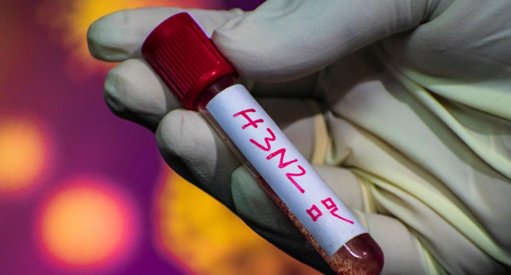 Colombia confirma primer caso de la variante K de influenza A(H3N2) en un menor de edad